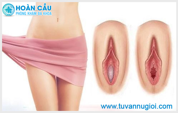 Giải đáp: Màng trinh bị rách có chảy nhiều máu không ?