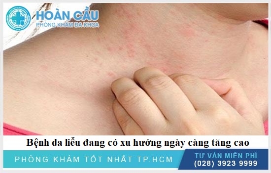 Nhu cầu thăm khám, chữa trị bệnh lý da liễu không ngừng tăng cao