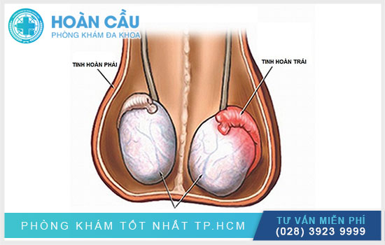 Các bệnh thường gặp liên quan đến tinh hoàn