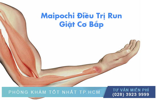 Maipochi Điều Trị Giựt Cơ Bắp