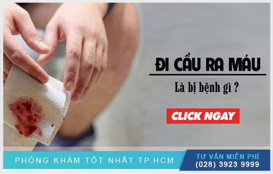 [TPHCM] Áp dụng ngay 3 cách trị đi cầu ra máu tại nhà đơn giản, hiệu quả