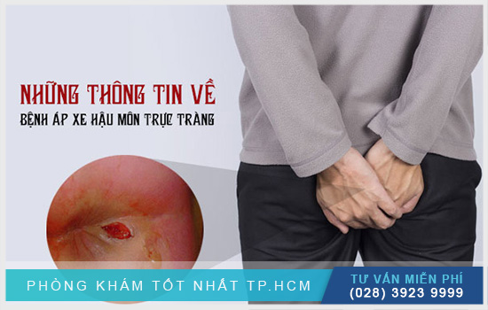 [TP.HCM] Apxe hậu môn là gì, nguyên nhân, ảnh hưởng cùng giải pháp điều trị