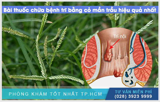 [TPHCM] Mẹo chữa bệnh trĩ bằng cỏ mần trầu đơn giản hiệu quả