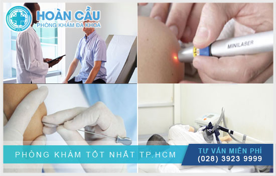 Một số phương pháp điều trị đau nửa đầu tại Hoàn Cầu