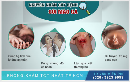 nguyên nhân gây sùi mào gà ở nam giới