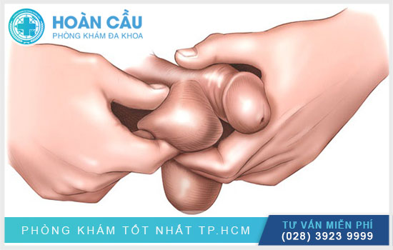 Phương pháp tự kiểm tra tình trạng tinh hoàn