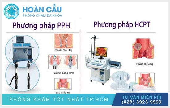 Cắt trĩ nhanh chóng – hiệu quả bằng phương pháp PPH và HCPT