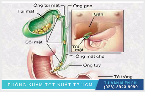 Vì sao chúng ta cần phải giải độc gan?