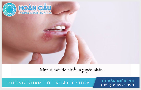 Bị mụn môi là do đâu và chữa trị bằng cách nào?