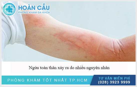 Ngứa toàn thân do nhiều nguyên nhân gây ra