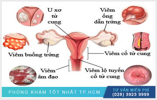 Trễ kinh 2 tháng nhưng không có thai do nhiều nguyên nhân