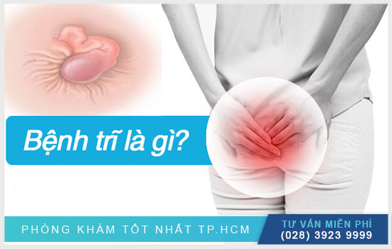 [TPHCM] Bị trĩ không đơn giản như bạn vẫn nghĩ