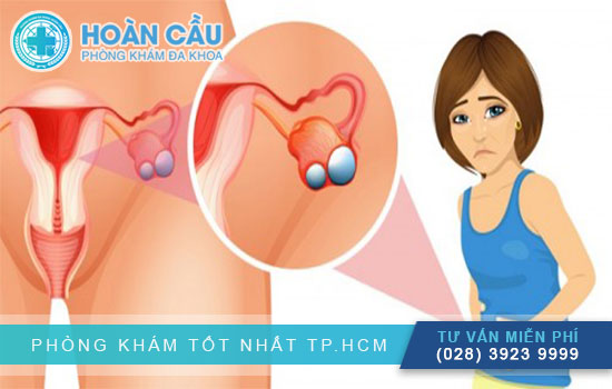 Topics tagged under titanhealthy on Diễn đàn Tuổi trẻ Việt Nam | 2TVN Forum - Page 3 Bi-u-nang-buong-trung-co-quan-he-duoc-khong-2