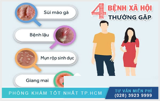 Các bệnh xã hội thường gặp bao gồm những bệnh gì, nguy hiểm không?