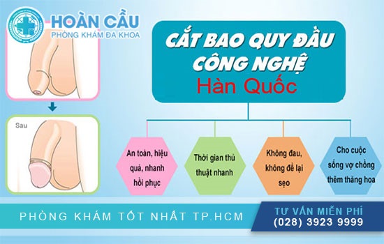 Cắt bao quy đầu bằng xâm lấn tối thiểu tại Hoàn Cầu