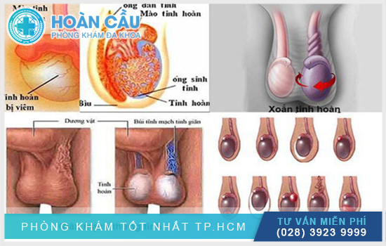 Có nhiều nguyên nhân gây đau tinh hoàn