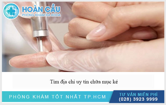 Cần tìm địa chỉ uy tín chữa mụn ké