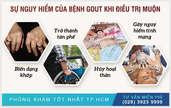 Cảnh báo những biến chứng do bệnh gout gây ra [TPHCM - Bình Dương - Đồng Nai - Long An - Tiền Giang]