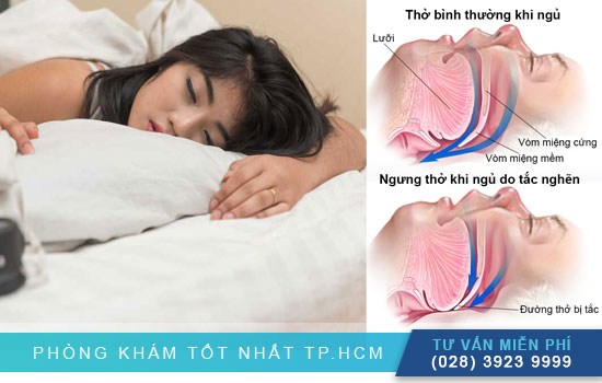 (TPHCM) Cẩn trọng với 5+ yếu tố gây ra chứng ngưng thở khi ngủ