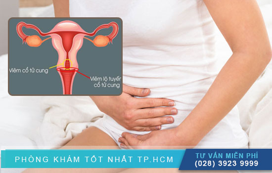 [TPHCM] Chị em phụ nữ sau sinh bị viêm lộ tuyến tử cung nên làm gì?
