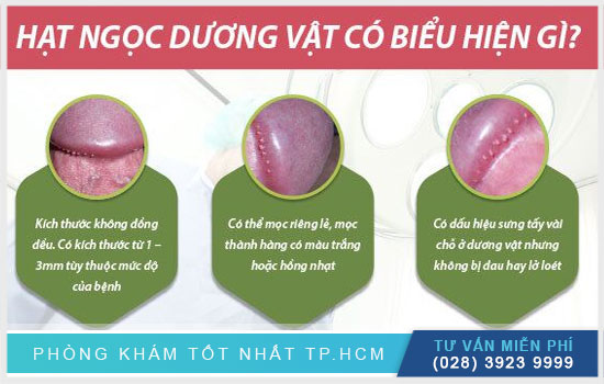 Chuỗi hạt ngọc dương vật có chữa được bằng kem đánh răng Chua-hat-ngoc-duong-vat-bang-kem-danh-rang-co-mang-lai-hieu-qua-nhu-mong-doi1