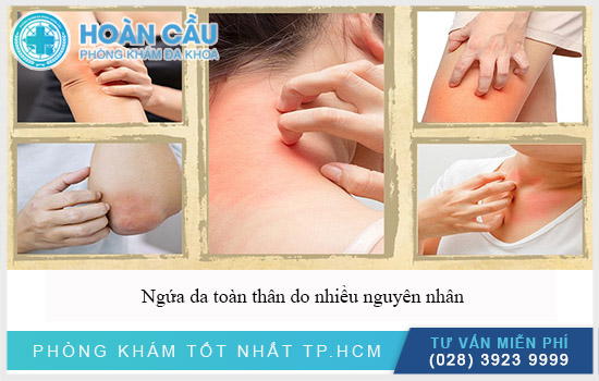 Có nhiều nguyên nhân gây ngứa da toàn thân