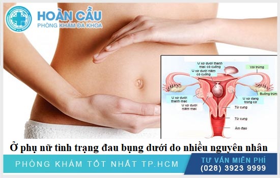 Ở phụ nữ đau bụng dưới cảnh báo nhiều dấu hiệu bệnh lý khác nhau