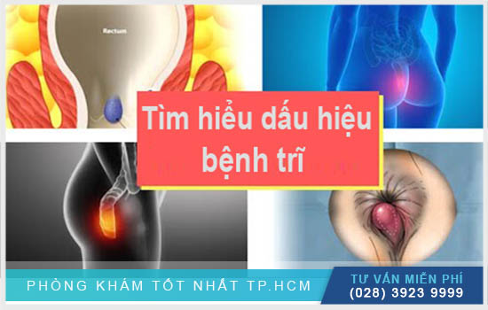 [TP.HCM] Dấu hiệu bị trĩ qua từng cấp độ và loại trĩ, cách điều trị hiệu quả