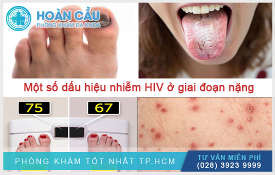 Dấu Hiệu Nhiễm Hiv Và Con đường Lây Truyền Bệnh