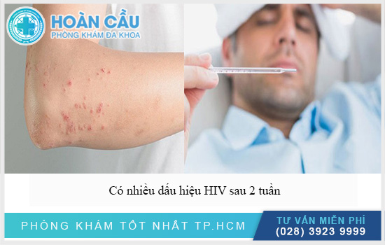 Có nhiều dấu hiệu HIV sau 2 tuần