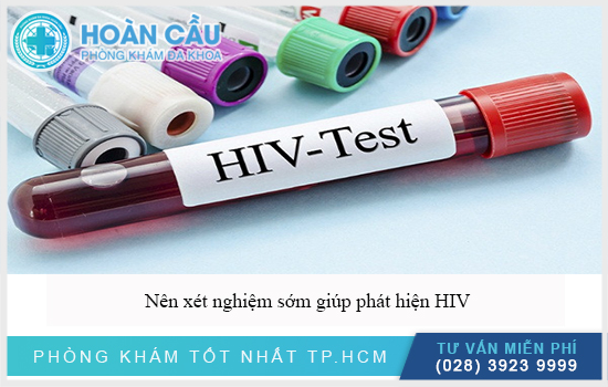 Nên xét nghiệm sớm HIV