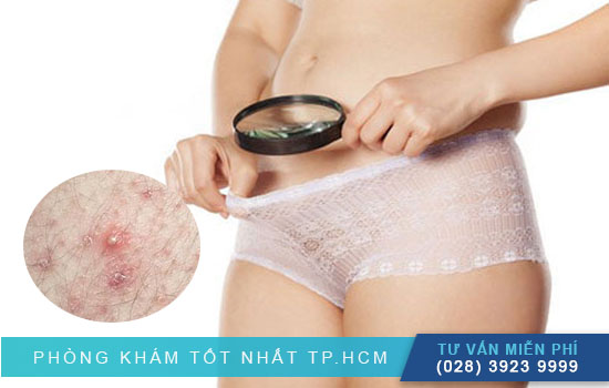 [TPHCM] Dấu hiệu viêm bộ phận sinh dục nữ và cách chữa tại nhà hiệu quả