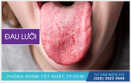 Đau lưỡi – dấu hiệu cảnh báo ung thư lưỡi chớ coi thường!
