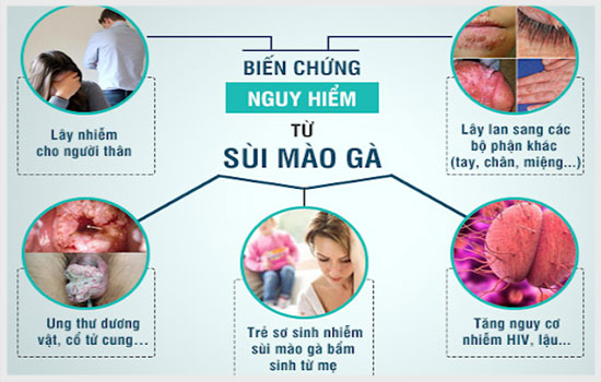 biến chứng nguy hiểm của sui mào gà