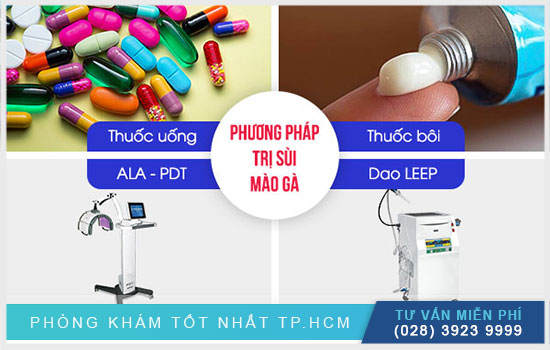 phương pháp điều trị sùi mào gà