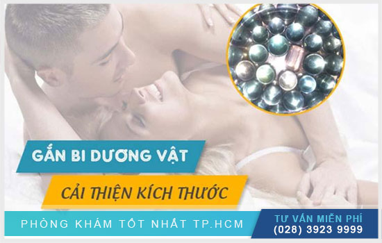 gắn bi của quý nam giới