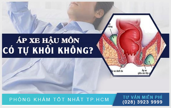 [TPHCM] Giải đáp: áp-xe hậu môn có tự khỏi không?