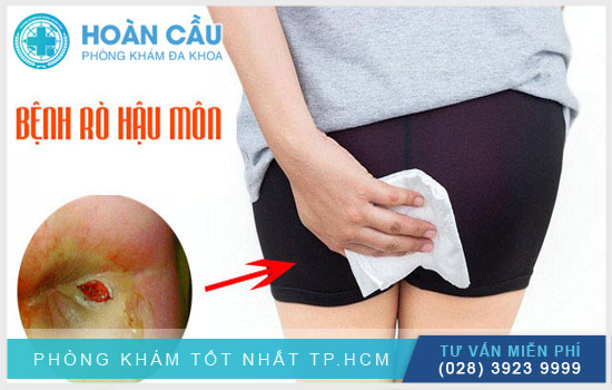 Rò hậu môn - bệnh lý hậu môn cần sớm được điều trị