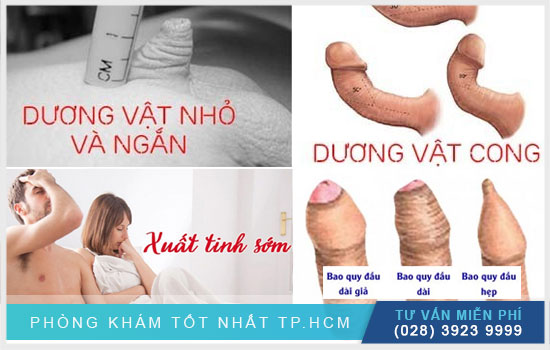 Kich thuoc duong vat dan ong Viet Nam