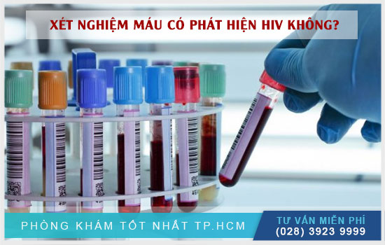 xét nghiệm máu có phát hiện HIV không