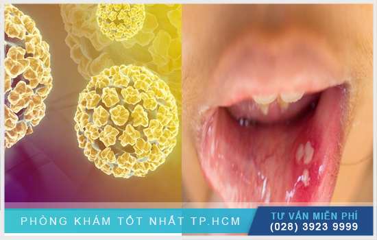 HPV ngủ đông trong bao lâu Hpv-ngu-dong-trong-bao-lau-mot-so-thong-tin-lien-quan-can-biet-2