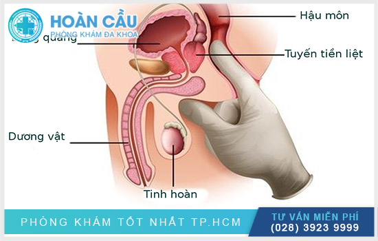 Khám tiền liệt tuyến là nhu cầu của nhiều nam giới