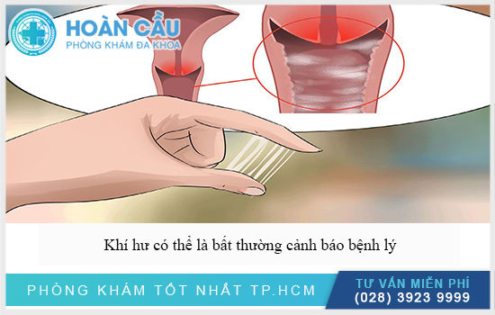 Khí hư bất thường cảnh báo nhiều bệnh lý khác nhau