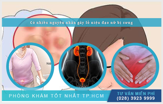 HCM - Lỗ niệu đạo sưng là do nguyên nhân nào? cách chữa trị hiệu quả  Lo-nieu-dao-nu-bi-sung-do-nguyen-nhan-nao-va-chua-tri-o-dau-2