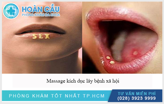 Massage kích dục bằng miệng với gái massage có lây bệnh xã hội không?