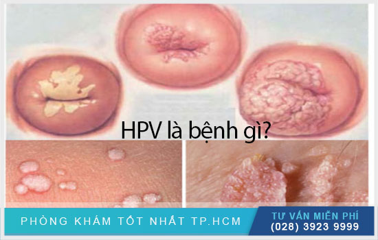 Mẹ bị nhiễm HPV có thể cho con bú được không? [TPHCM - Bình Dương - Đồng Nai - Long An - Tiền Giang]