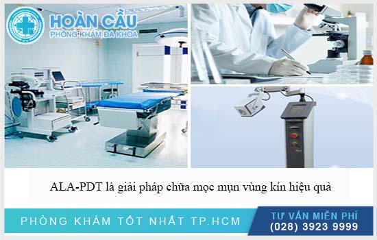 ALA-PDT là giải pháp chữa mọc mụn vùng kín an toàn hiệu quả cao