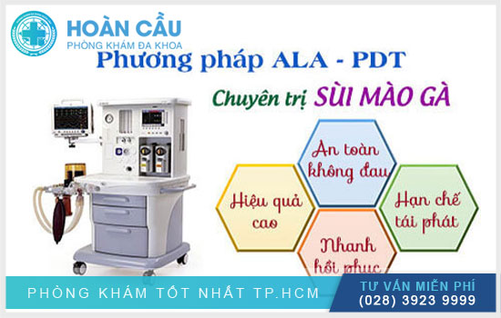 Liệu pháp quang học ALA-PDT