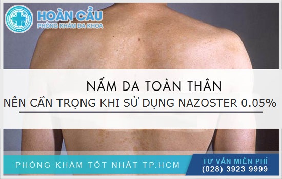 Người bị nhiễm nấm toàn thân nên cẩn trọng khi sử dụng Nazoster 0.05%