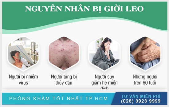 Nguyên nhân bệnh giời leo Nguyen-nhan-bi-gioi-leo-thuong-gap-va-cach-dieu-tri-hieu-qua